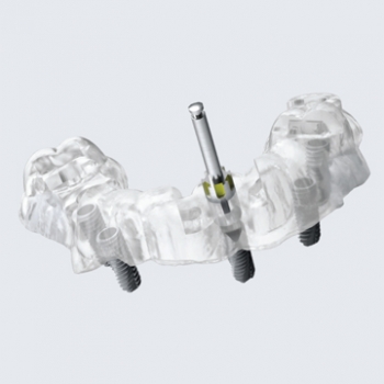 THIẾT KẾ - IN MÁNG HƯỚNG DẪN CẮM IMPLANT