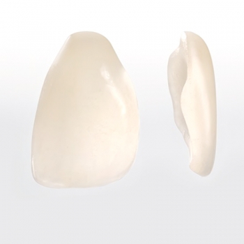 MẶT DÁN SỨ VENEER