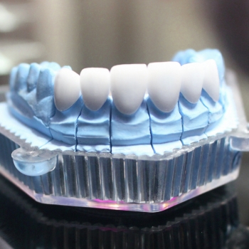 PHỤC HÌNH RĂNG SỨ HT-SMILE