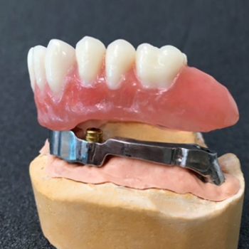 PHỤC HÌNH THÁO LẮP TRÊN THANH T-BAR