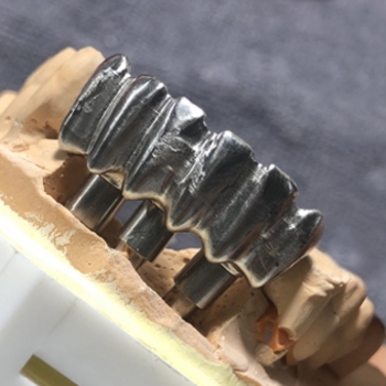 HÀM HYBRID CROM - COBAN